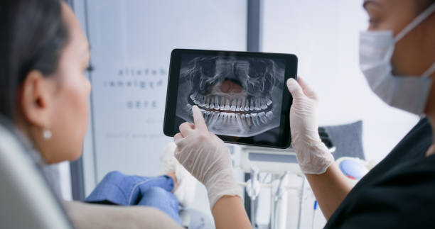Licensed Root Canal Treatment service in North Liberty, IA - Smile Center Dentistry